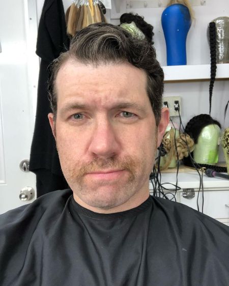 There was a news regarding Billy Eichner's eye defect.